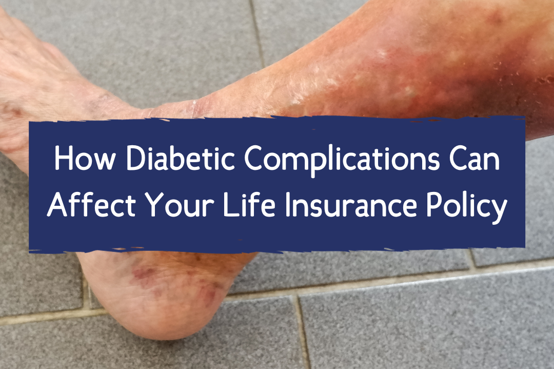 How Diabetic Complications Can Affect Your Life Insurance Policy